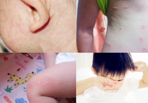 深圳殺蟲公司如何滅螨蟲除四害 (12).jpg