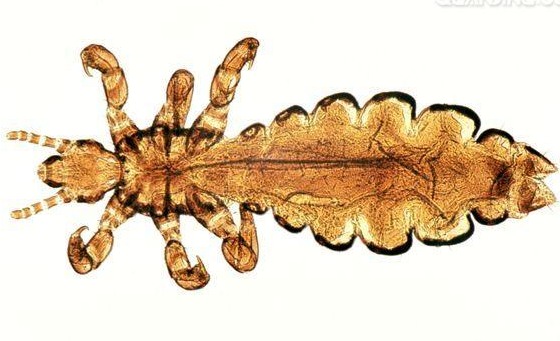 深圳殺蟲公司如何滅虱子有什么有效的辦法 (51).jpg